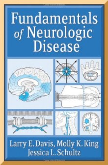 Fundamentals of Neurologic Disease