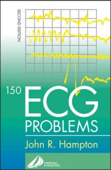 150 ECG Problems