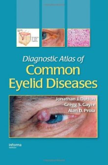 Diagnostic Atlas of Common Eyelid Diseases