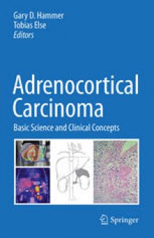 Adrenocortical Carcinoma: Basic Science and Clinical Concepts