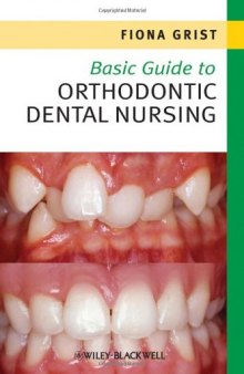 Basic Guide to Orthodontic Dental Nursing (Basic Guide Dentistry Series)