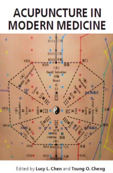 Acupuncture in modern medicine