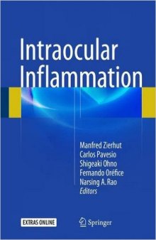 Intraocular Inflammation