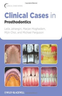 Clinical Cases in Prosthodontics