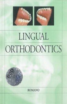 Lingual orthodontics