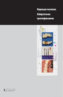 Коррекция окклюзии Избирательное пришлифовывание