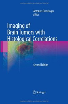 Imaging of Brain Tumors with Histological Correlations