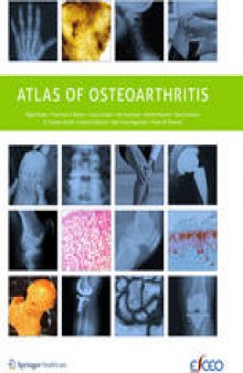 Atlas of Osteoarthritis