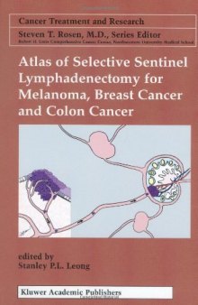 Atlas of Selective Sentinel Lymphadenectomy for Melanoma, Breast Cancer and Colon Cancer