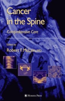 Cancer in the Spine: Comprehensive Care 