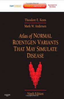 Atlas of Normal Roentgen Variants That May Simulate Disease