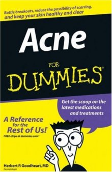 Acne For Dummies