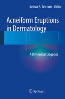 Acneiform Eruptions in Dermatology: A Differential Diagnosis