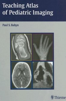 Teaching Atlas of Pediatric Imaging (Teaching Atlas Series)