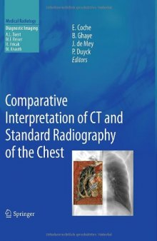 Comparative Interpretation of CT and Standard Radiography of the Chest