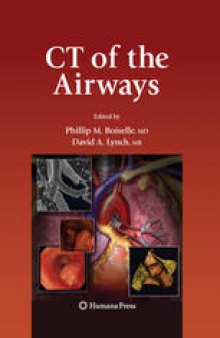 CT of the Airways