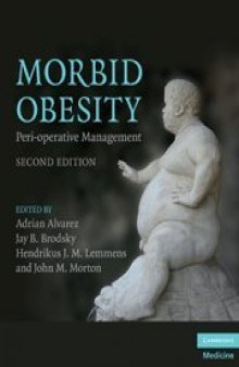 Morbid Obesity: Peri-operative Management