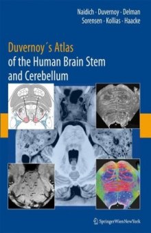 Duvernoy's Atlas Of The Human Brain Stem And Cerebellum