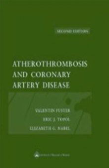 Atherothrombosis and coronary artery disease