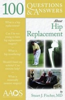 100 Questions & Answers About Hip Replacement