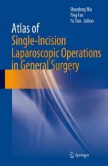 Atlas of Single-Incision Laparoscopic Operations in General Surgery