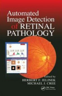 Automated Image Detection of Retinal Pathology  