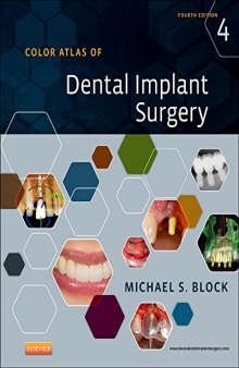 Color Atlas of Dental Implant Surgery, 4e