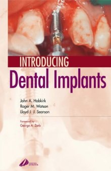 Introducing Dental Implants