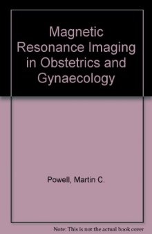 Magnetic Resonance Imaging in Obstetrics and Gynaecology