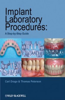 Implant Laboratory Procedures: A Step-by-Step Guide