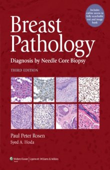 Breast Pathology: Diagnosis by Needle Core Biopsy