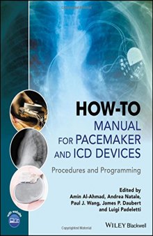 How-to Manual for Pacemaker and ICD Devices: Procedures and Programming