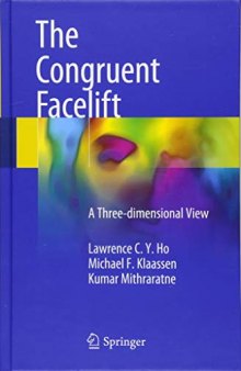 The Congruent Facelift: A Three-dimensional View