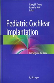 Pediatric Cochlear Implantation: Learning and the Brain