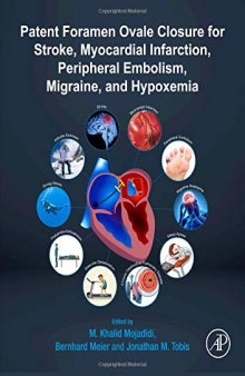 Patent Foramen Ovale Closure for Stroke, Myocardial Infarction, Peripheral Embolism, Migraine, and Hypoxemia