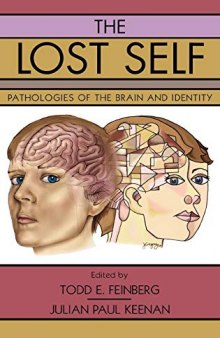 The Lost Self: Pathologies of the Brain and Identity