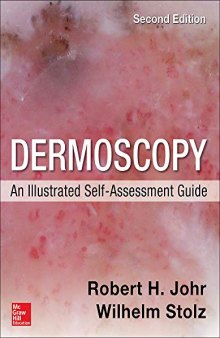 Dermoscopy: An Illustrated Self-Assessment Guide, 2/E