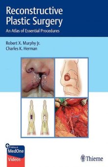 Reconstructive Plastic Surgery: An Atlas of Essential Procedures