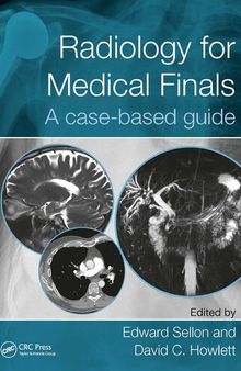 Radiology for Medical Finals: A case-based guide