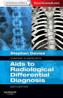 Chapman & Nakielny's Aids to Radiological Differential Diagnosis: Expert Consult - Online and Print