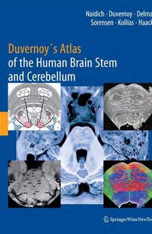 Duvernoy's Atlas of the Human Brain Stem and Cerebellum: High-Field MRI, Surface Anatomy, Internal Structure, Vascularization and 3 D Sectional Anatomy