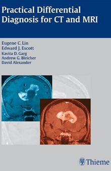 Practical Differential Diagnosis for CT and MRI