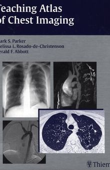 Teaching Atlas of Chest Imaging