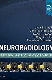 Neuroradiology: Spectrum and Evolution of Disease