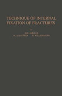 Technique of Internal Fixation of Fractures