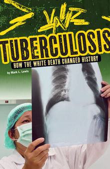 Tuberculosis: How the White Death Changed History