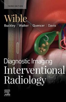 Diagnostic Imaging: Interventional Radiology