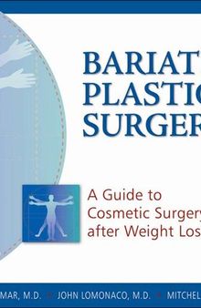 Bariatric Plastic Surgery: A Guide to Cosmetic Surgery After Weight Loss