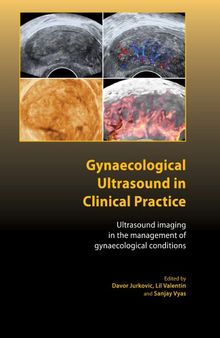 Gynaecological Ultrasound in Clinical Practice: Ultrasound Imaging in the Management of Gynaecological Conditions