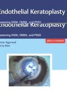 Endothelial Keratoplasty: Mastering DSEK, DMEK, and PDEK